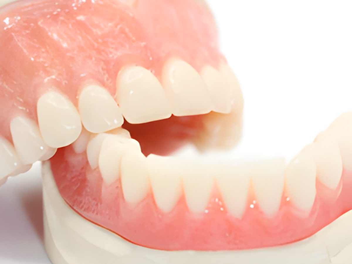 Full Arch Info Image