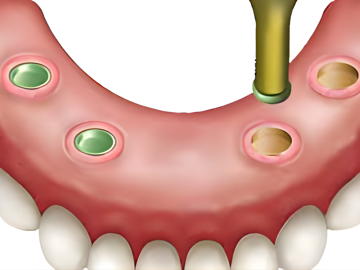 LFX Whats Needed Image