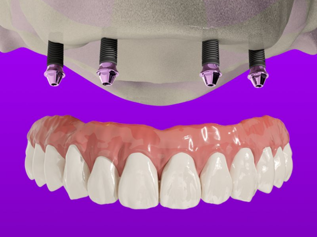 Spectrum Killian AOX Thumbnail