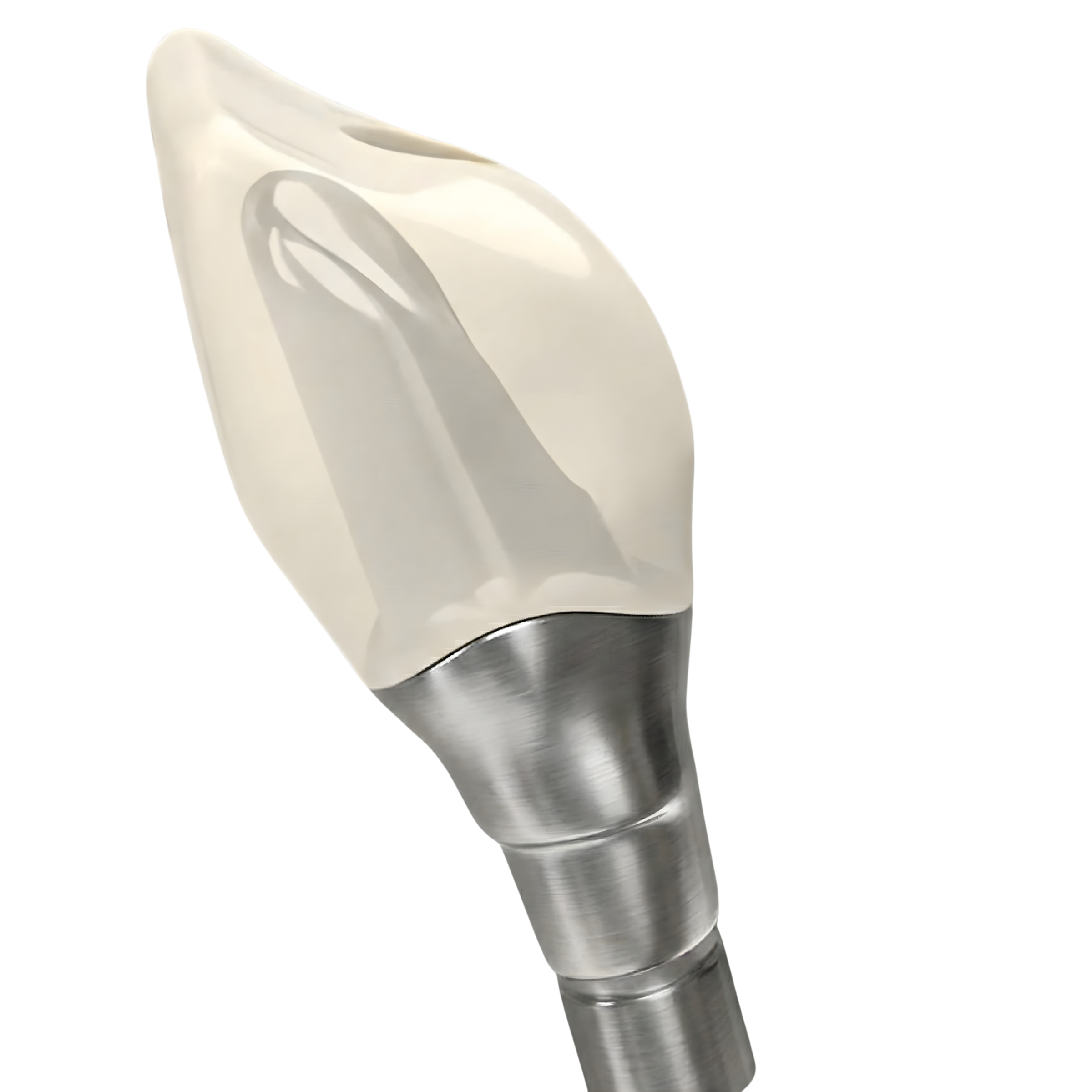 Vulcan Bundle - Screw Retained Crown